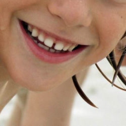 Alimentación y salud bucodental infantil