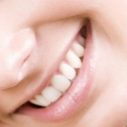 Siete alimentos malos para los dientes